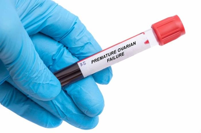 Premature Ovarian Failure: Causes, Symptoms & Prevention