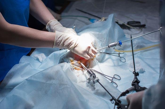Best Laparoscopic Surgeon in Guna
