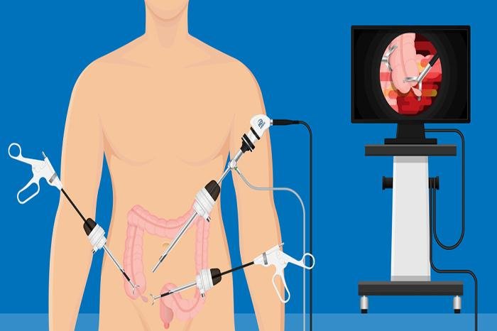 Best Laparoscopic Surgeon in Gwalior