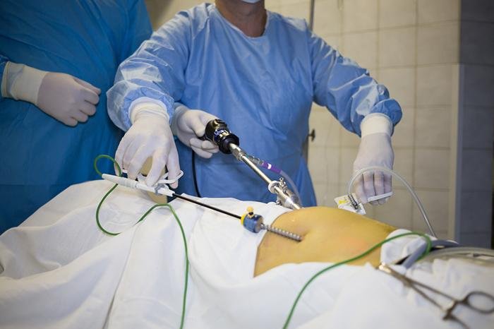 Best Laparoscopic Surgeon in Rewa