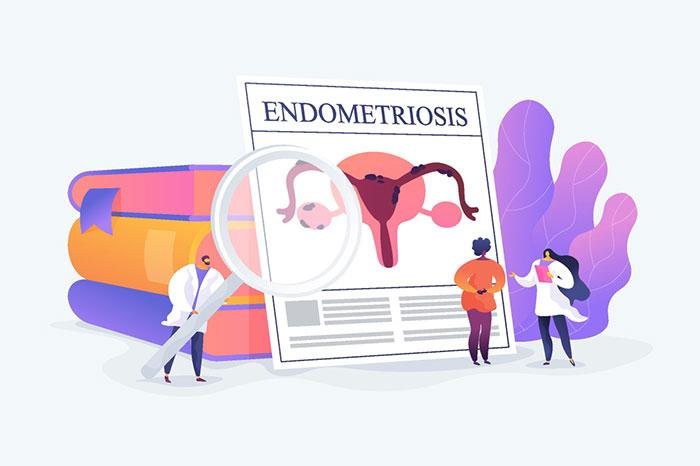How To Identify If You Have Endometriosis