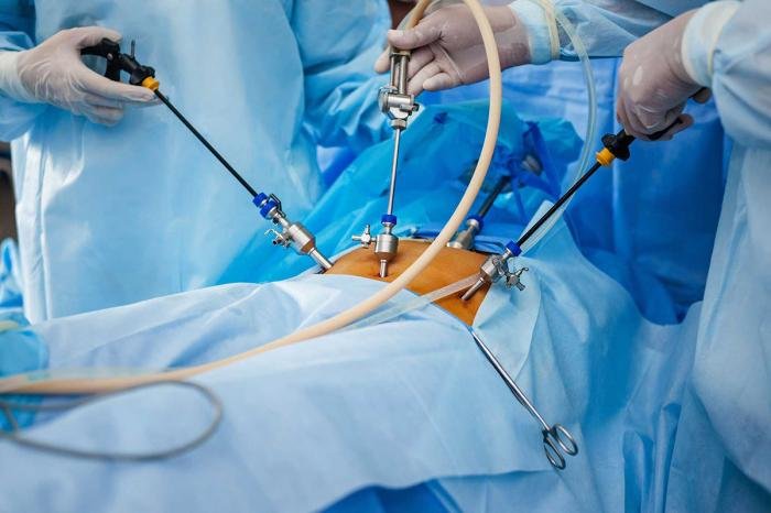 Know Why The Doctor Conducts Laparoscopy And The Risks Associated With It