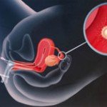 Best Test Tube Baby Center in Indore