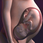 High-Risk Pregnancy Treatment in Indore